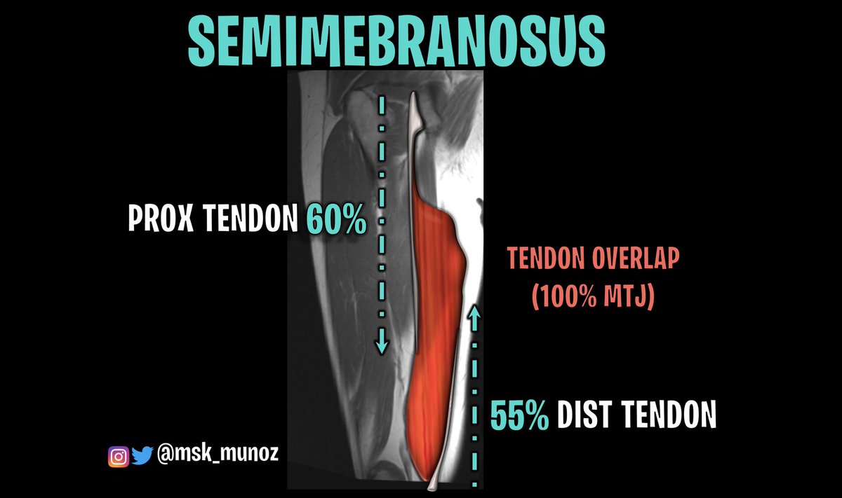HAMSTRINGS: TENDON & MTJ

#msk #anatomy #sportsmedicine