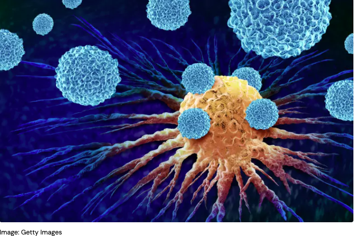 KAWstiftelsen's tweet photo. Långsinta mördarceller kan öka överlevnaden i hudcancer. Forskare @karolinskainst har identifierat hur dessa celler bildas  något som kan bidra till bättre #immunterapi #Forskning med stöd av Knut och Alice Wallenbergs Stiftelse #KAW100 #Cancer #svmed https://t.co/U894I6NYWS https://t.co/OVOVQyToME