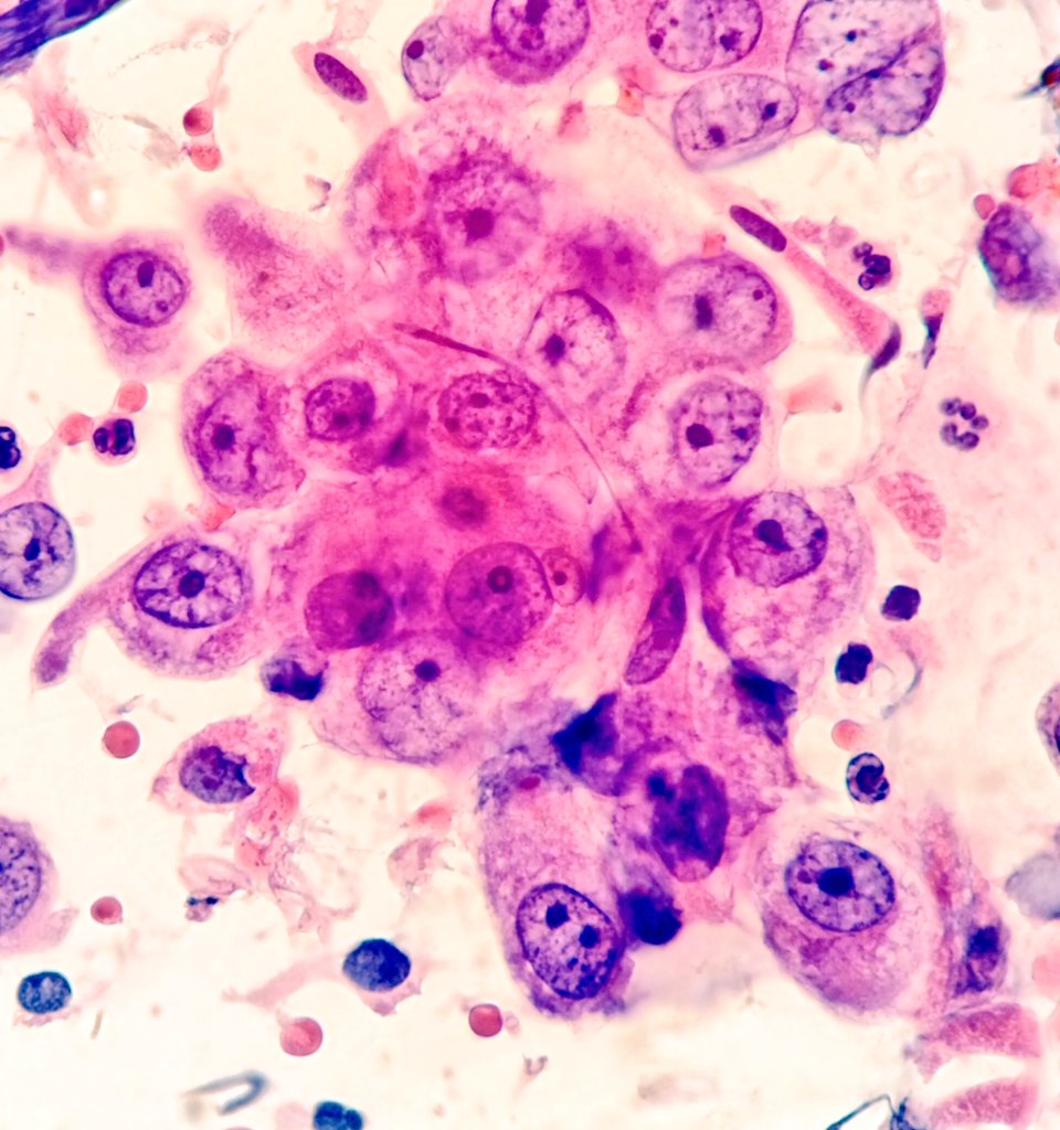 Héctor-Enrique Torres-Rivas, MD, MIAC tweet media