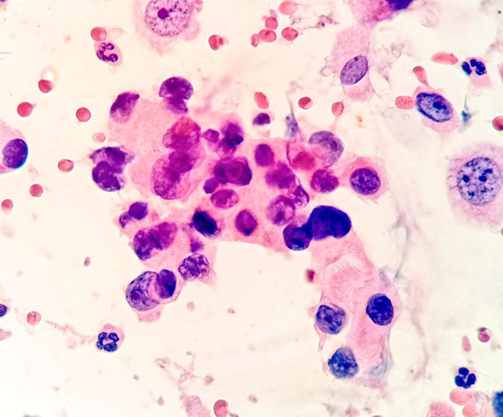 Héctor-Enrique Torres-Rivas, MD, MIAC tweet media