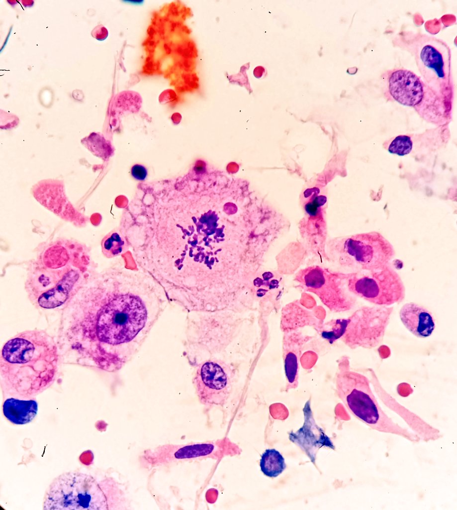 Héctor-Enrique Torres-Rivas, MD, MIAC tweet media