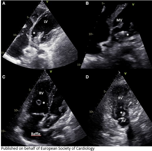 European Society of Cardiology Journals tweet media