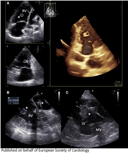 European Society of Cardiology Journals tweet media