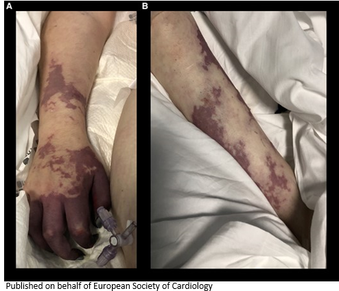 European Society of Cardiology Journals tweet media