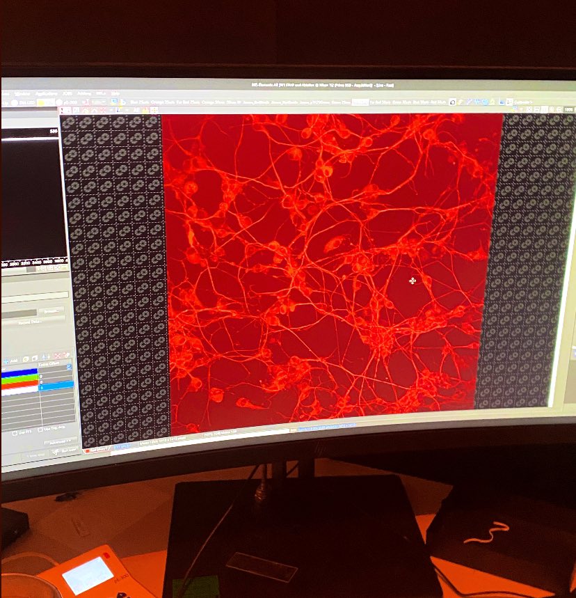 Dila_htn's tweet photo. 💫Trust your research,
Despite minor heart attacks! ✨😉

👩🏻‍🔬PhDiaries👩🏻‍💻

#DoingPhD #WomenInScience #WomenInSTEM #Neuroscience #PeripheralNerve #Biomaterial #TheUniversityofSheffield https://t.co/QCW2UCbDlA