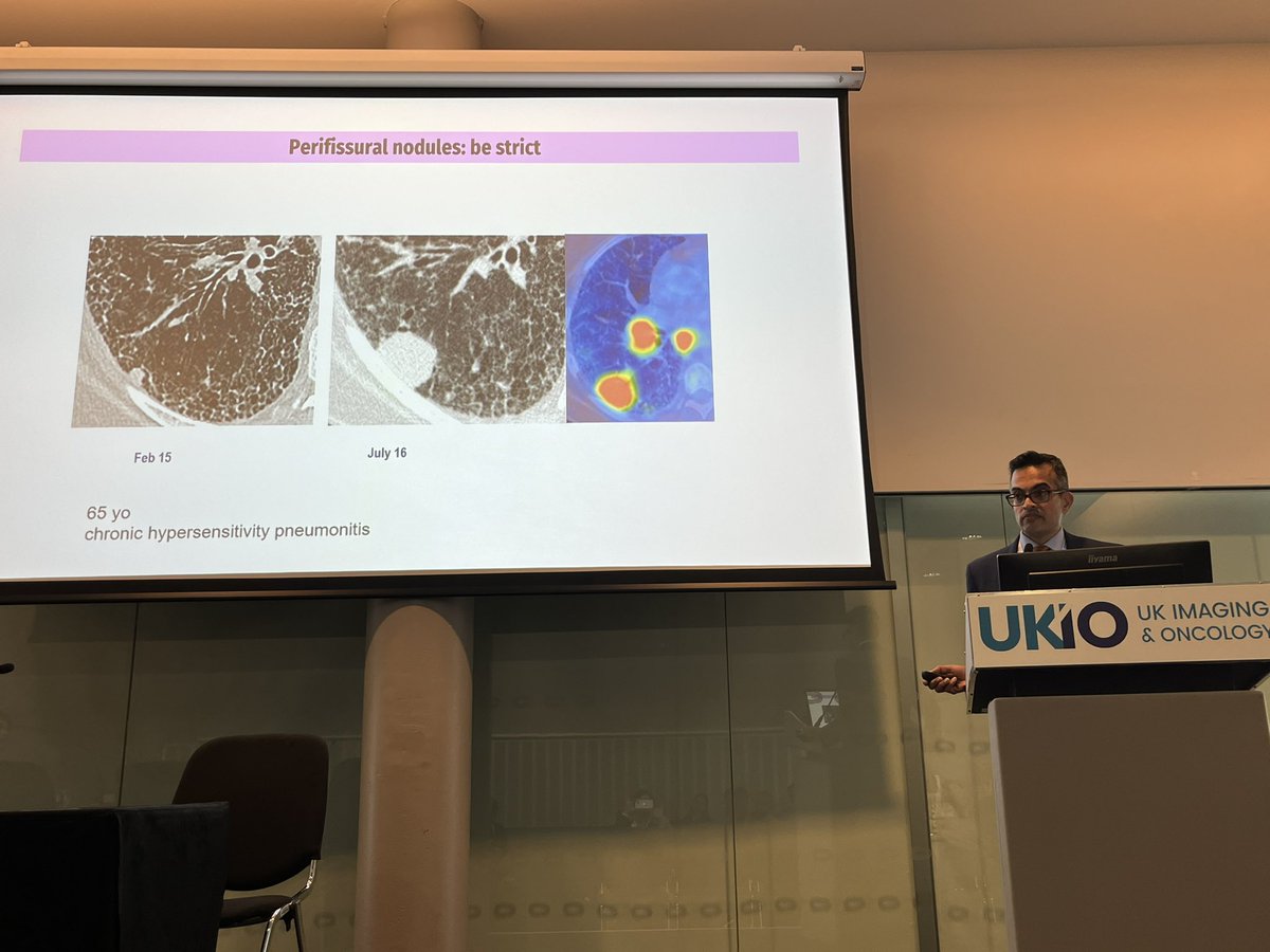 Always great to hear the fabulous @lungradiologist talking about his favourite topic of nodules #UKIO2023