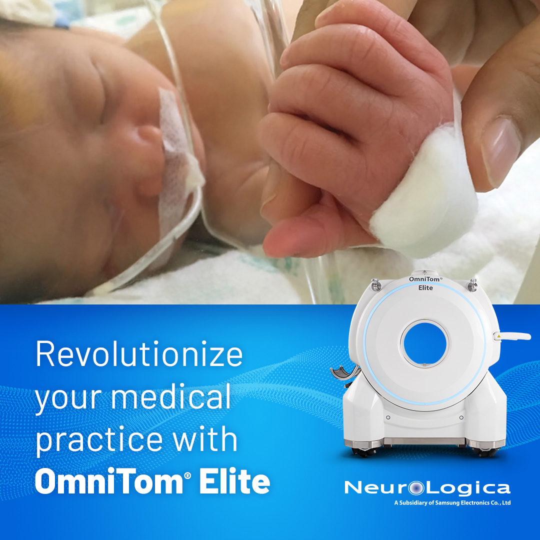 Standardize your imaging needs with The OmniTom® Elite mobile CT scanner.

OmniTom® Elite for NICU/PICU offers diagnostic accuracy and reliability that can be standardized to your fixed CT systems:

💻 ALARA radiation dose for infants and children
💻 40cm bore for full-body…