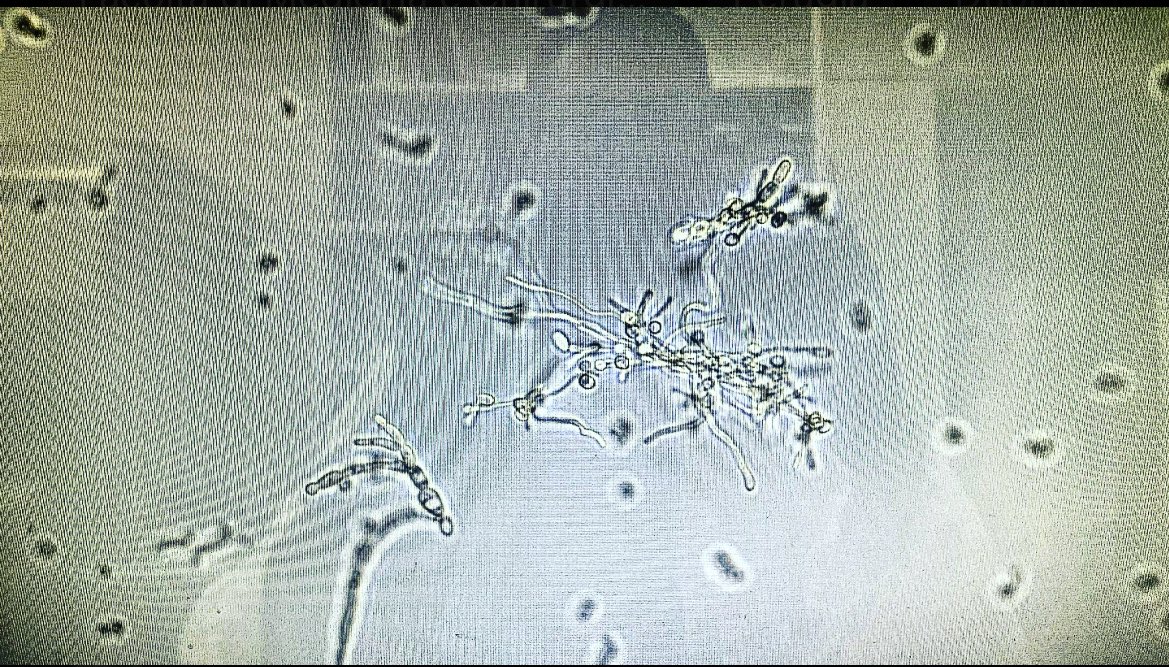 Ondřej Vymazal (@ovymazal) on Twitter photo ...and here we are. #CandidaAlbicans #unipg <a href="/UniperugiaNews/">Università degli Studi di Perugia</a> ...and here we are. #CandidaAlbicans #unipg <a href="/UniperugiaNews/">Università degli Studi di Perugia</a>