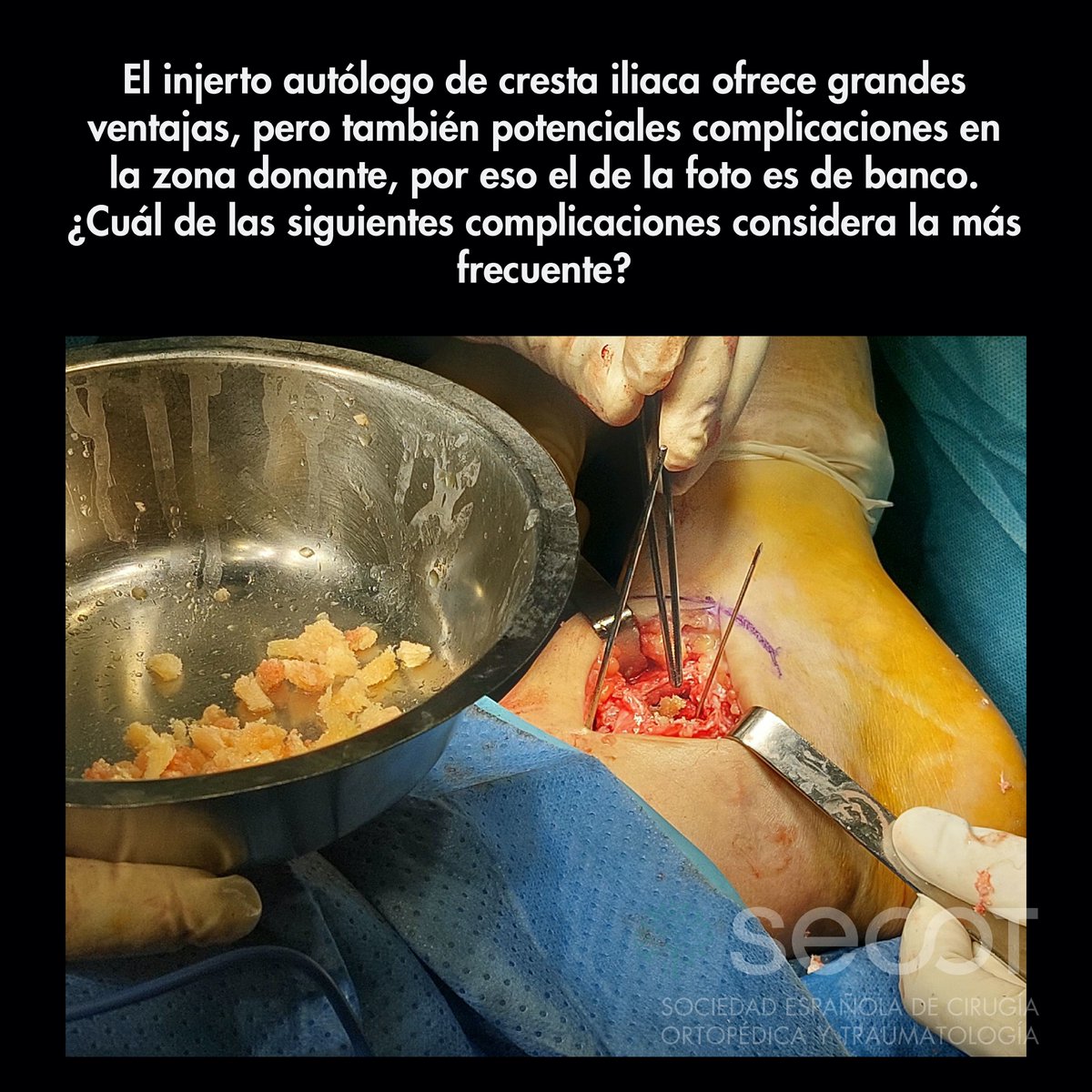 @secotsecot tweet media