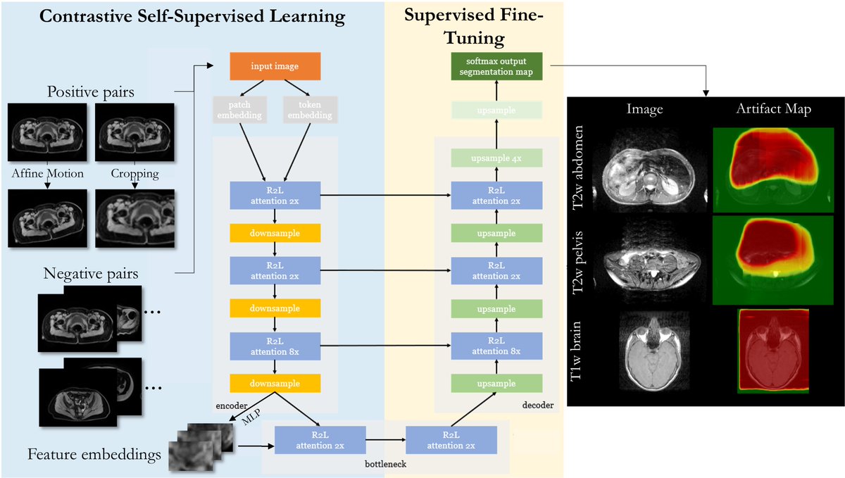 📢 Please join me today at #ISMRM23 for my digital poster #1818 (1:45pm, computer 1) about robust motion detection in multiple imaging cohorts.
<a href="/lab_midas/">MIDAS.lab</a>
