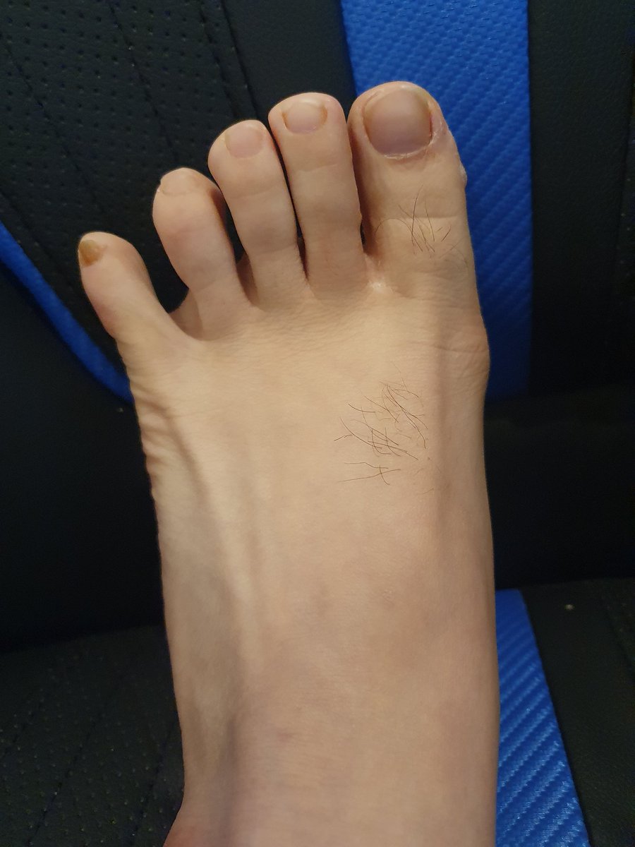 y23bs's tweet photo. #남자발 #mansfeet https://t.co/PtYMUwgybF