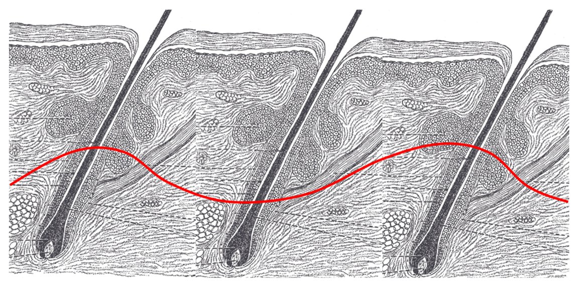 Manual of Resource-Limited Surgery on Twitter: