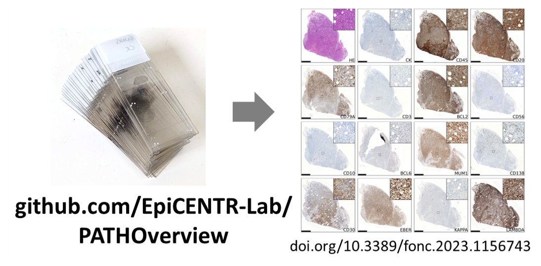 Epithelial Cell Biology in ENT Research Group (@epicentr_ich) on Twitter photo With <a href="/SwantonLab/">Swanton Lab</a>, we've developed a new python package - PATHOverview - to semi-automatically compile #digitalpathology #NanoZoomer images into publication ready figures: github.com/EpiCENTR-Lab/P…
The first output was published today <a href="/FrontOncology/">Frontiers - Oncology</a>: doi.org/10.3389/fonc.2… With <a href="/SwantonLab/">Swanton Lab</a>, we've developed a new python package - PATHOverview - to semi-automatically compile #digitalpathology #NanoZoomer images into publication ready figures: github.com/EpiCENTR-Lab/P…
The first output was published today <a href="/FrontOncology/">Frontiers - Oncology</a>: doi.org/10.3389/fonc.2…