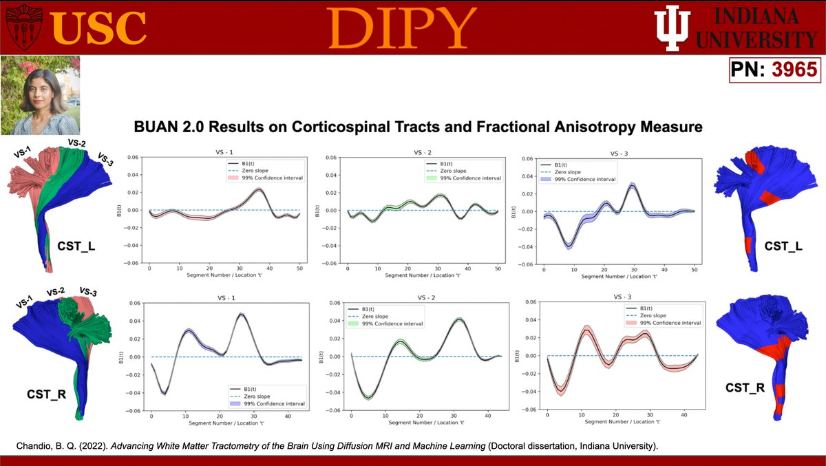 Are you attending <a href="/ISMRM/">ISMRM</a> ? Stop by our poster# 3965 to learn about “BUAN 2.0, streamlines as functions, nonlinear registration, and subdivision of bundles for advanced tractometry“
Session Name: DTI &amp; DWI III
Wednesday, 07 June 2023
Time: 13:30 (Toronto time)
Computer: 32 #ISMRM