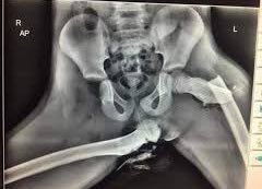 Desiiah's tweet photo. Et un dernier pour la route, vu que c’est bientôt les départs en vacances. Les pieds sur le tableau de bord en tant que passager, c’est sympathique. Bon par contre, en cas d’accident, à part si vous voulez enfin tester la non solidité de vos os, évitez. C’était tout pour moi 😚 https://t.co/KfekFxHOUL