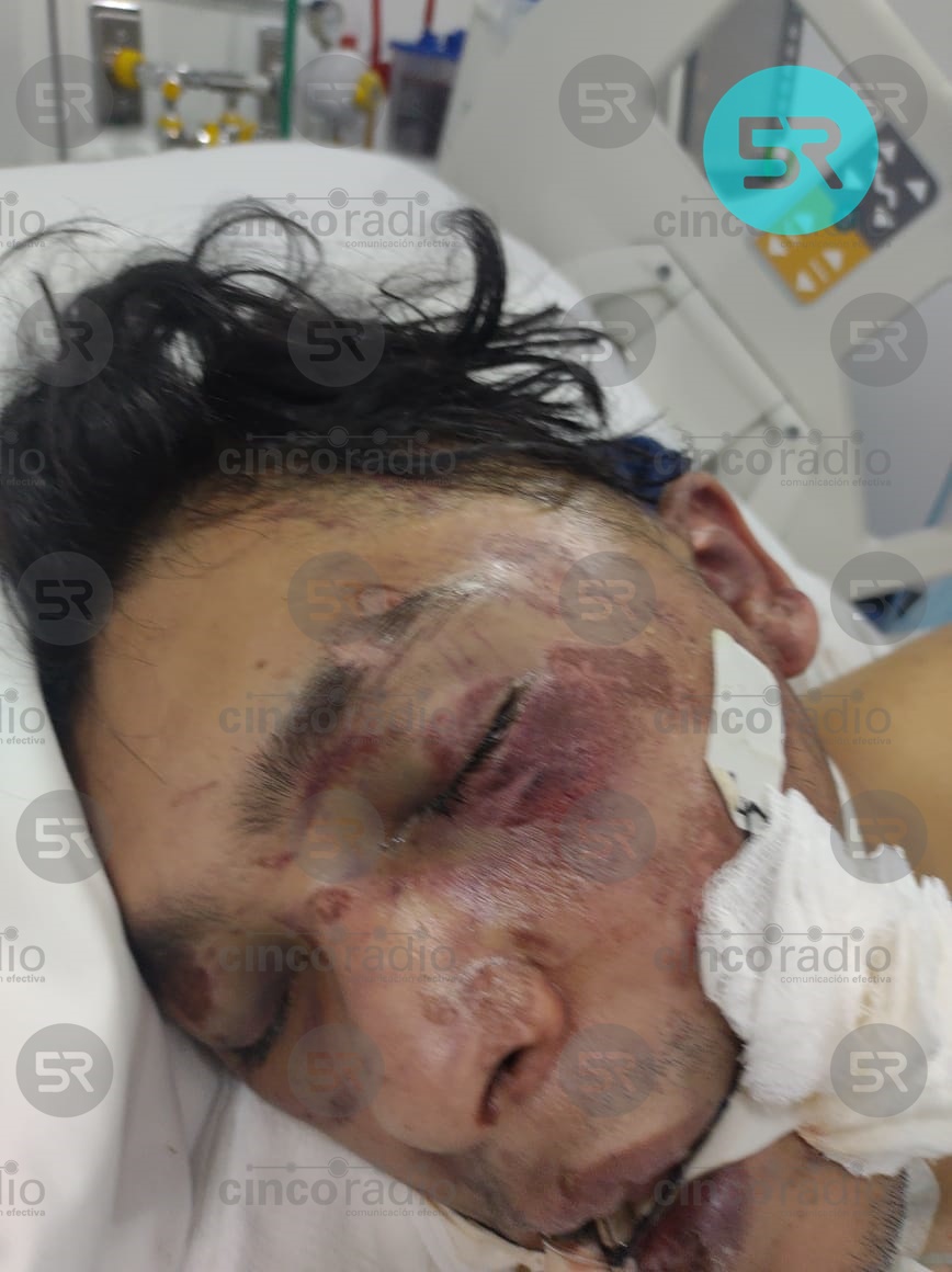 laredcincoradio's tweet photo. #ServicioSocial 📢 || Urge localizar a los familiares de paciente quien llegó gravemente lesionado al Hospital de Traumatología y Ortopedia del Sector Salud, encontrado en la Colonia Amor #LaRedCincoRadio #Puebla https://t.co/y9G7UwMrVT