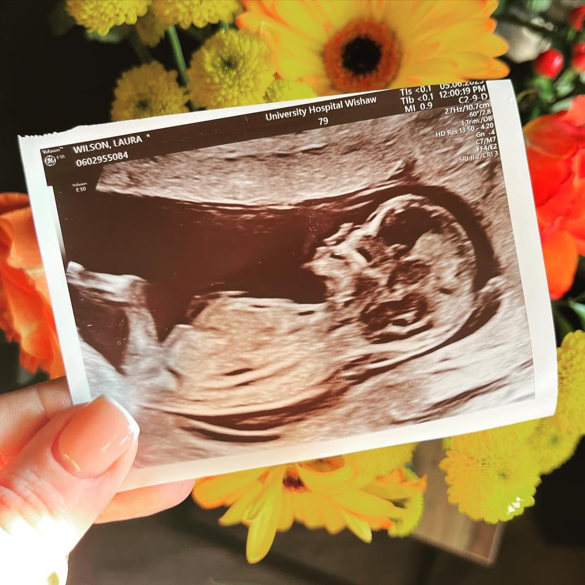 StevenW1192's tweet image. 2023 is going to end with a bang 

Baby Wilson due December 💙💙