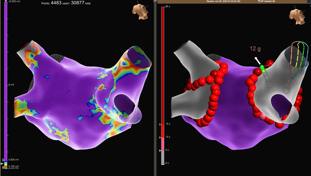 Anne Kroman tweet media