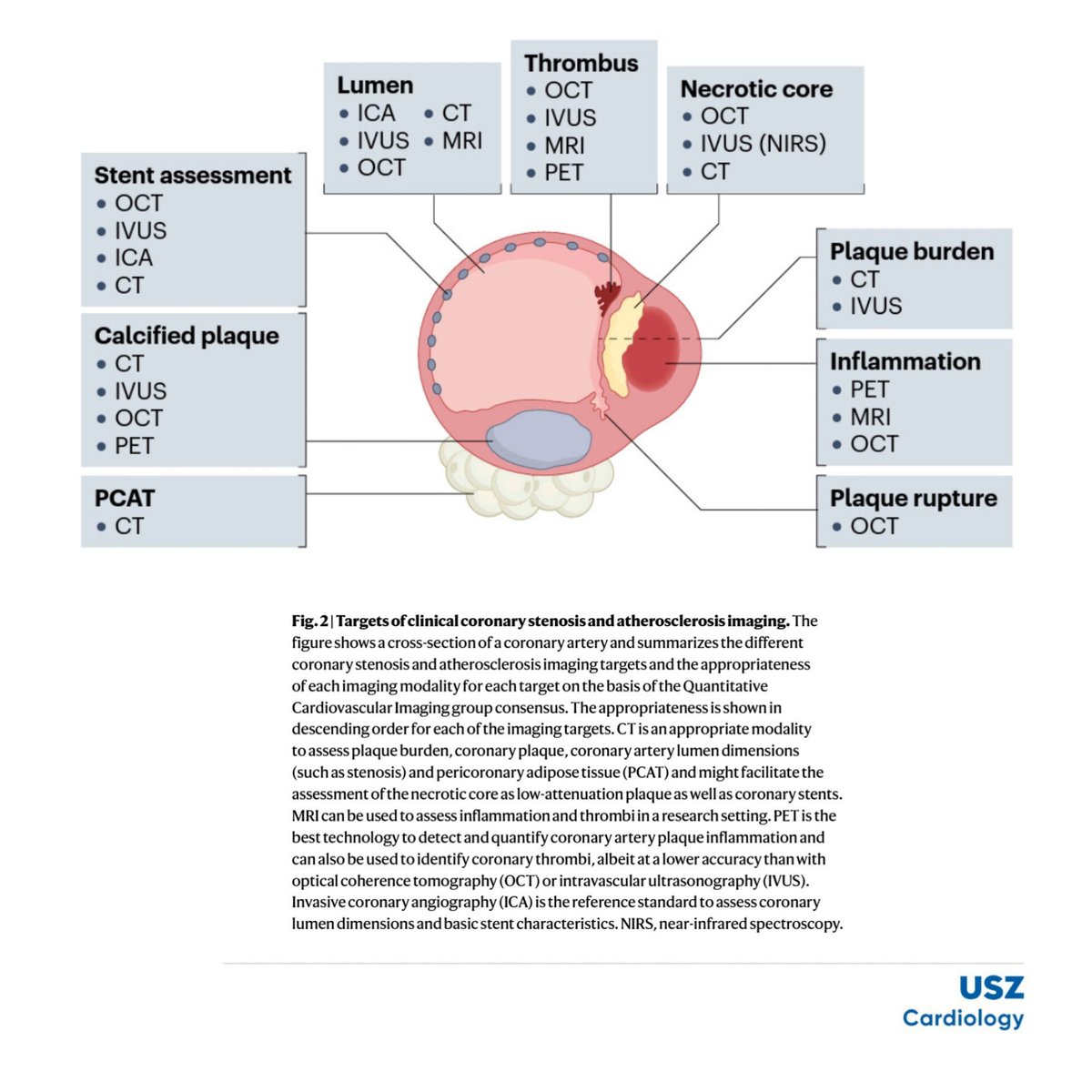 CardioZurich's tweet image. Consensus 📃 #multimodality 🎦 in #CAD &amp;amp; #Atherosclerosis!
👏🏻 @Alkadhi_rad @rmanka_ @andgiannopmd @RadiologieUSZ @CardioZurich @CMR_Zurich 🫱🏻‍🫲🏼 @F_Biavati @ProfDewey @team_dewey @ETH_en @dfg_public @dhzcharite @team_dewey 🔎

📚nature.com/articles/s4156…

#WhyCMR #YesCCT #IVUS