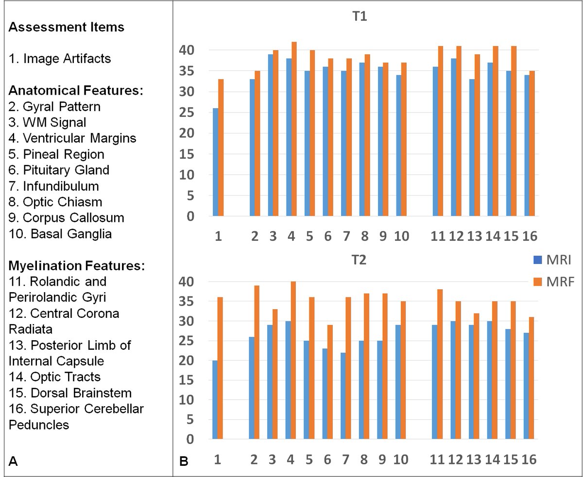 MRI_Dan's tweet image. Check out our 'motion robust MRF for non-sedated infant imaging!' presented by @MRI_ChaitraB, and featured as 1 of the top 100 abstracts at @ISMRM this year!  Our non-sedated subjects are those with prenatal opioid exposure. Abstract No. 0045