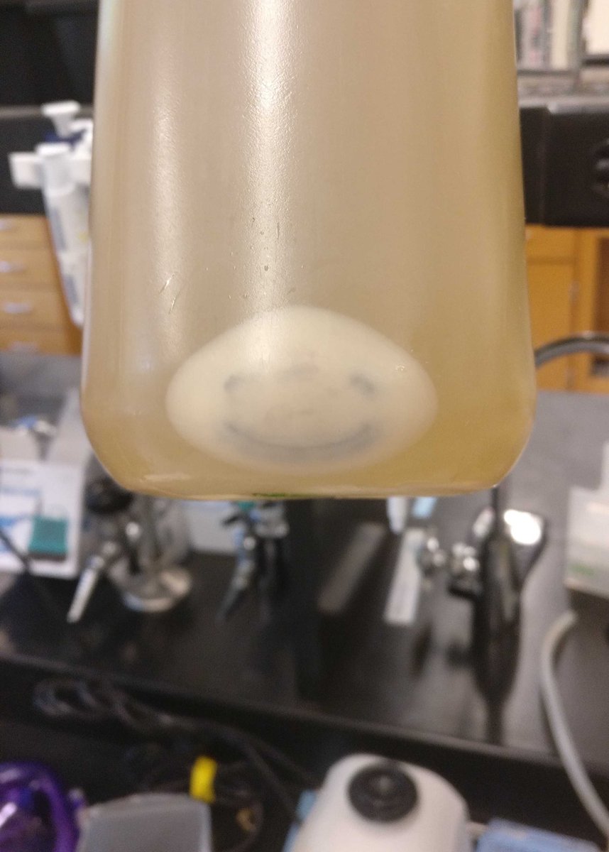 A previous thesis student saw this in a cell pellet and I think about it all the time