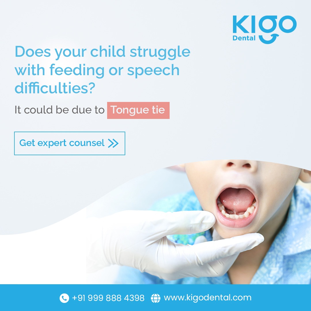 Tongue tie can affect your child's oral health and development. Visit Kigo Dental for expert evaluation and treatment options. Book your appointment today.
website https: //kigodental.com/
KigoDental  #Kigo #dental #tonguetie #tonguetierelease  #tonguetieproblem #tonguetiesurgery