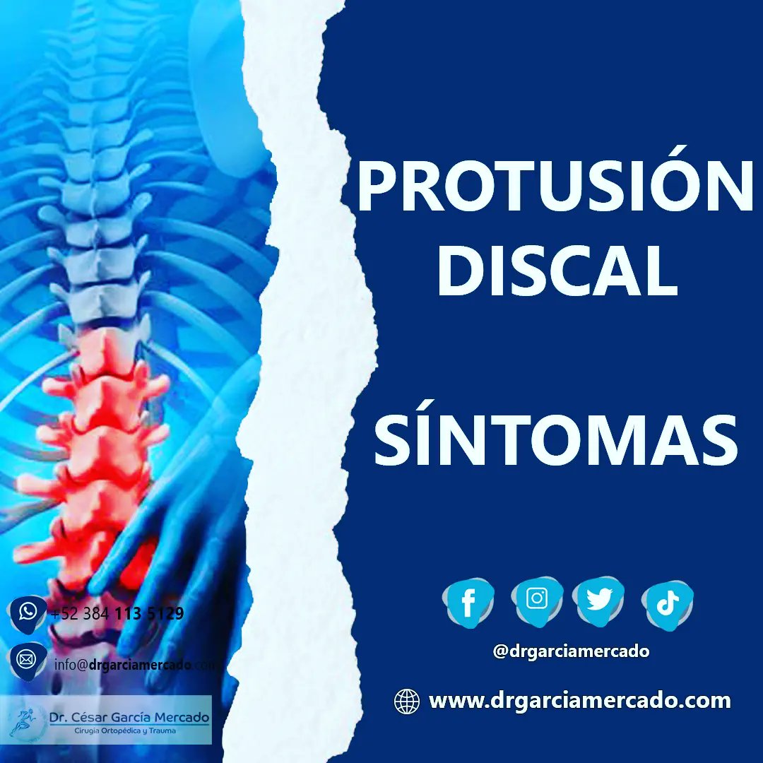 drgarciamercado's tweet photo. 🚨 PROTUSION DISCAL: Principales síntomas.
🥼 Dr. César García Mercado- Cirugía Ortopédica y Trauma 🩺🏥
📲 384 113 5129
🌐 https://t.co/rCeYB19b2Q
#traumatologia #traumatologo #fracturas #ortopedia #ortopediainfantil #protusiondiscal #vertebras #espalda #dolordeespalda https://t.co/QYJUF7yDZ9