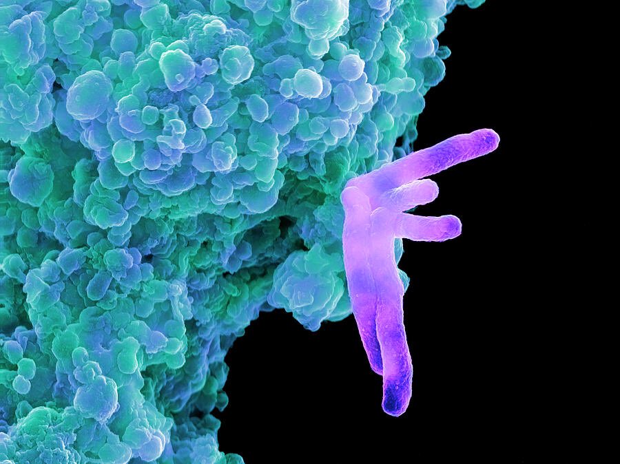 tuberculosis bacteria (purple) infecting a macrophage white blood cell under an electron microscope
