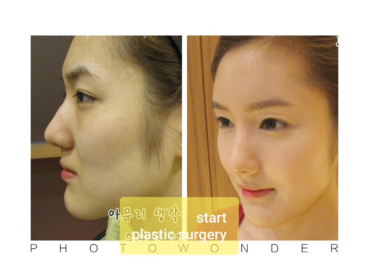 スタート整形外科&ヨンセUP整形病院の案内 tweet media