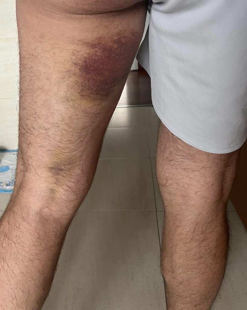 Alfonso Pérez Muñoz tweet media