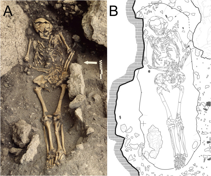 New case of Mesolithic violence just published: a young adult female who was attacked on at least two occasions, and killed with blunt force trauma to the skull. Let's take a look...