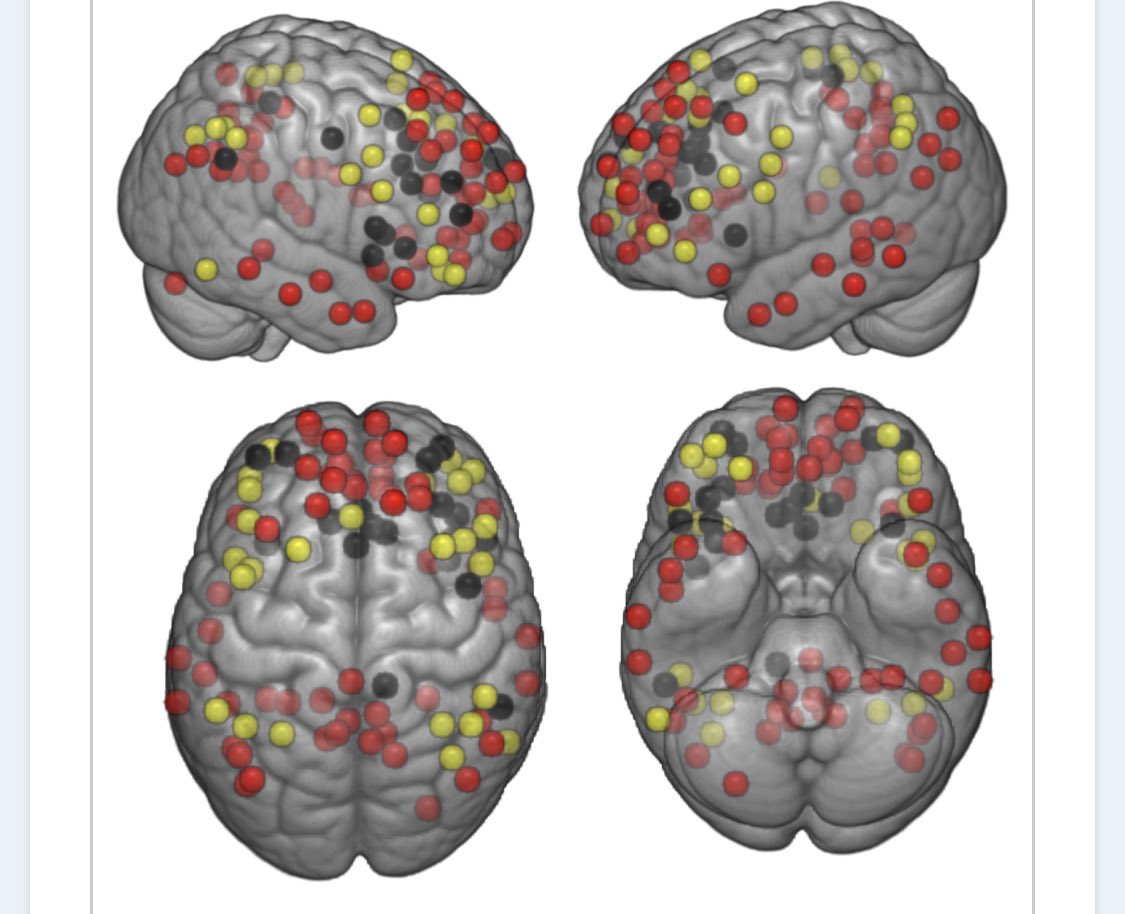Hafızasını güçlendirmek isteyen; haftada 3-4 kez, 40 dakikalık, tempolu yürüyüş yapsın!
📍Orta tempolu,aerobik egzersizlerin (yürüyüş gibi) düzenli yapılmasının beyinde hafıza ile ilişkili hipokampüs üzerinde nöroplastik etkileri gösterilmiş.
Yürümek =hafıza güçlendirici ilaç💊
