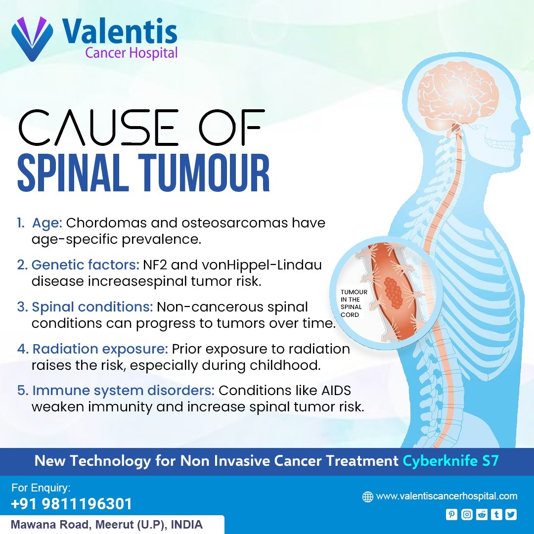 valentishospit1's tweet image. CAUSE OF SPINAL TUMOUR 
1. Age: Chordomas and osteosarcomas have age-specific prevalence. 
For more Information Visit-valentiscancerhospital.com/spinal-tumours…
Call us - 7599201717
#spinalcordtumor #tumor #spinalcordtumortreatment #tumor