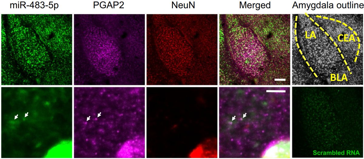 ams_bio's tweet photo. 🧠 Read about Prof. Pawlak &amp; team @ExeterMed utilising AMSBIO's custom lentiviral particles to unveil miR-483-5p's role in mitigating stress effects in male mice.➡️ https://t.co/dACNMl8gu1

🎯 More about AMSBIO's custom viral production services here ➡️ https://t.co/LIBJuQIjxS https://t.co/DMlVDeWoGW
