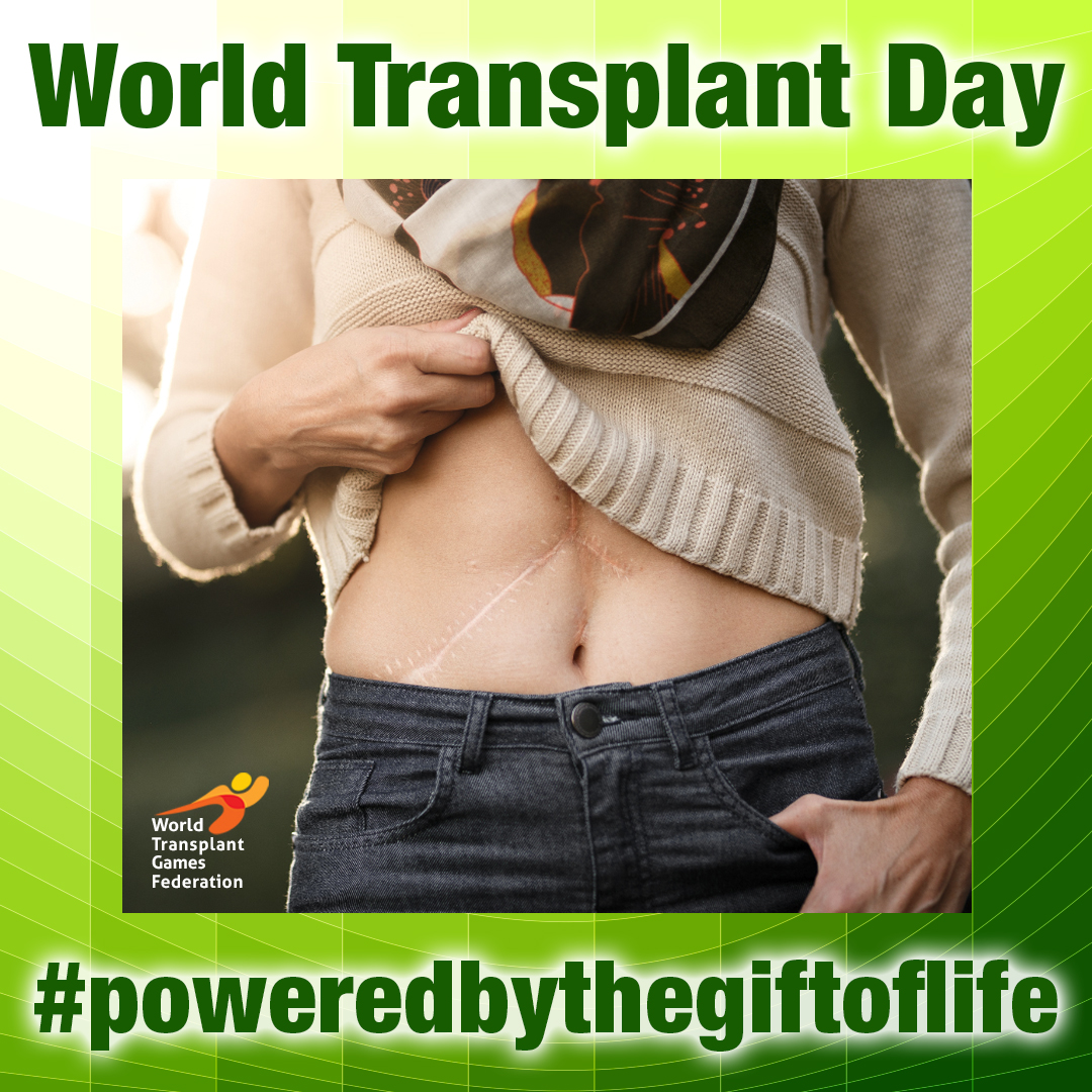 WTGF1's tweet photo. Through the power of #transplantation, hope is restored, lives are transformed and dreams reignited. World Transplant Day reminds the world that #organdonation changes lives. https://t.co/f51O9kguKq