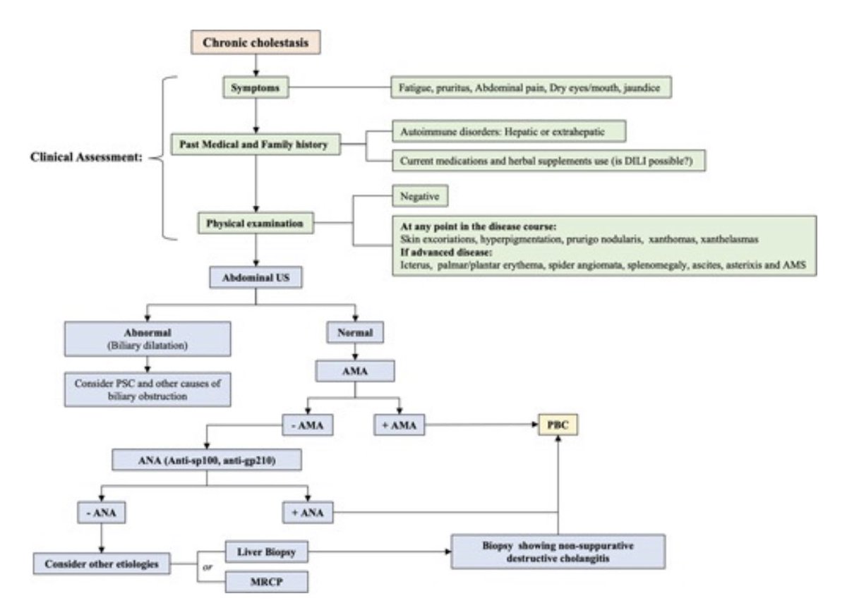 🔎Diagnosis🔎

🌟 Positive #AMA seen in 90-95%
🌟 +AMA ➕ chronic Cholestasis ➡️ diagnosis of PBC
🌟 30% have positive anti-sp100 and anti-gp210 (PBC-specific ANAs) ➡️ Can be helpful to ☑️ in AMA negative patients

Poor prognostic factors:
⬆️ ⬆️ bili, ⬆️ ⬆️ ALP
<a href="/docbinujohn/">Binu John</a>
