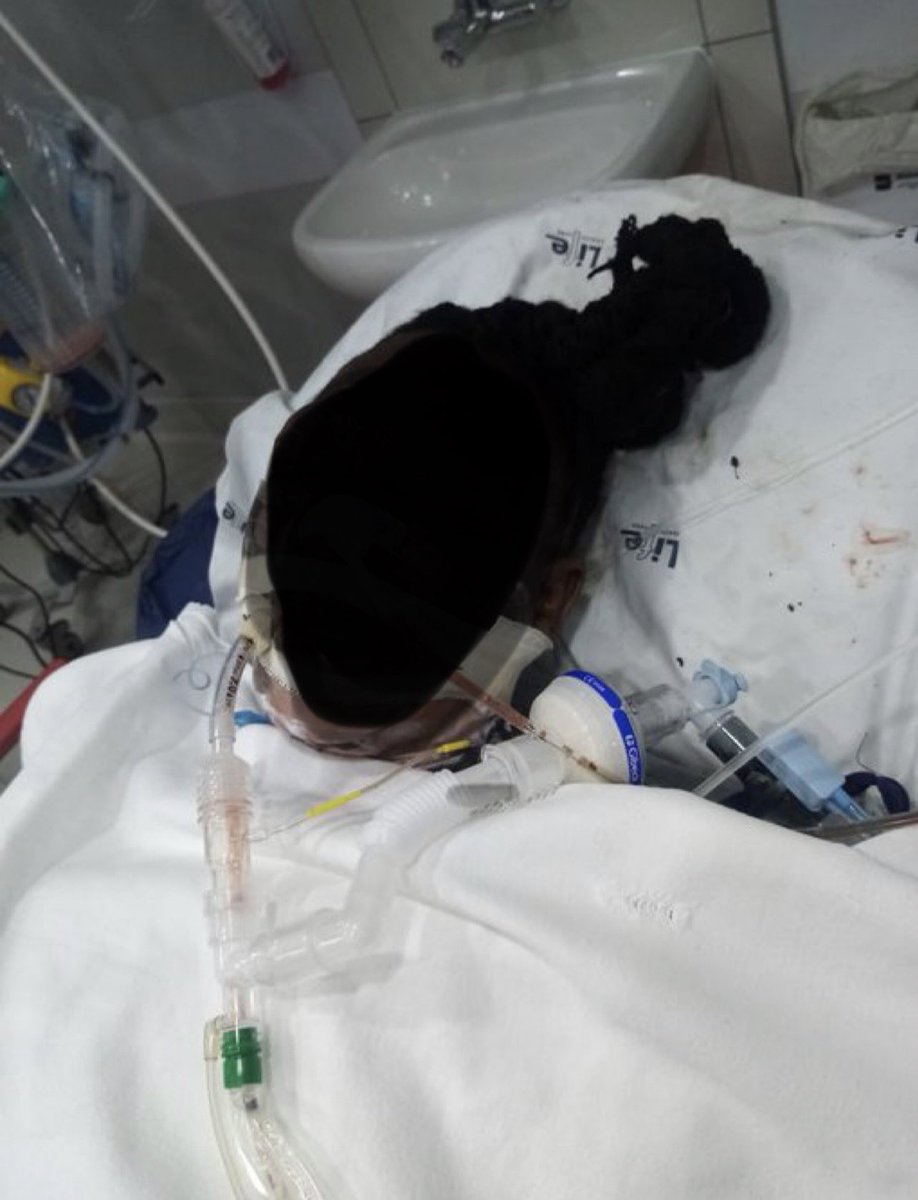 XoliswaZondo's tweet photo. 💔Prayers needed for former Banyana Banyana star, Lindiwe Zitha, who was burnt by her boyfriend.

Zitha is in hospital on life support after she was burnt head to toe by her boyfriend Eric Marakalala who poured petrol on her

Zitha’s brother was also burnt trying to save her💔 https://t.co/4eUWjoLdKn