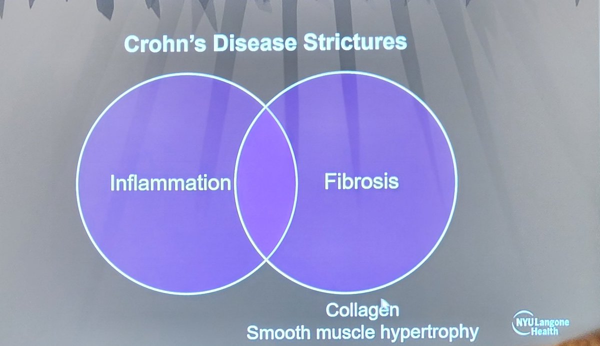 Dr. @BariDaneMD making a critical point @ISMRM #ISMRM23 ... #fibrosis and #inflammation commonly overlap in #Crohn strictures! Motility and magnetization transfer may hold clues? @MotilentNews @NYURadResearch