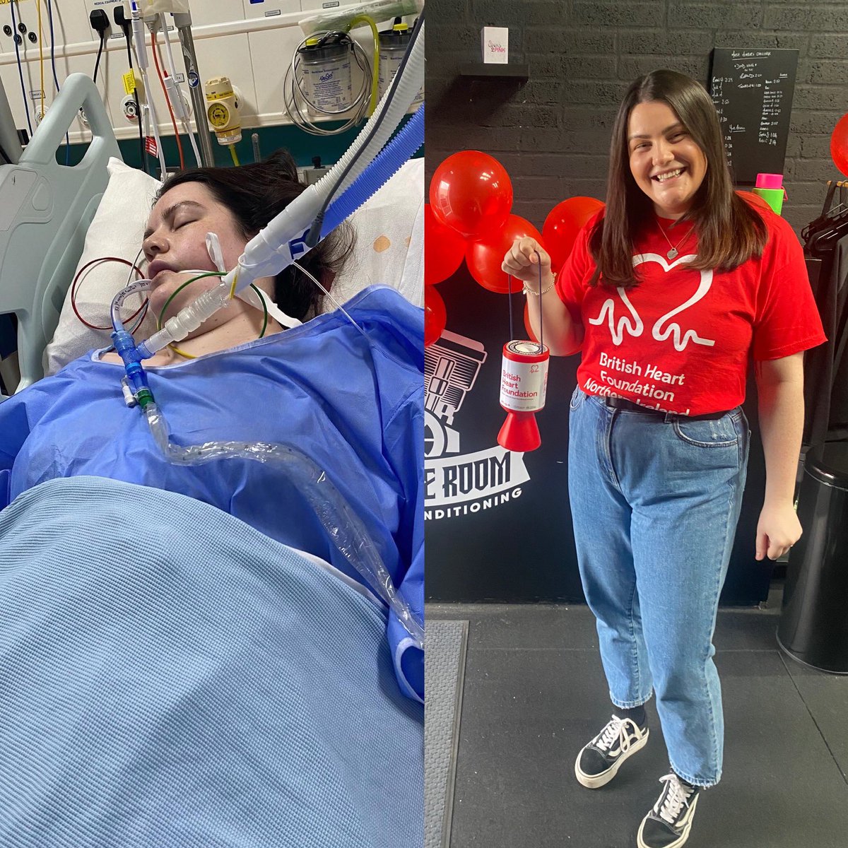 Ciara9429's tweet image. On 1st April this year, one year since my cardiac arrest, I organised a day where people could come and learn CPR. It has become so important in my life and I am so grateful to be here today and able to share this skill with others❣️… here’s to many more 🤞🏼
#cprawareness @BHFNI