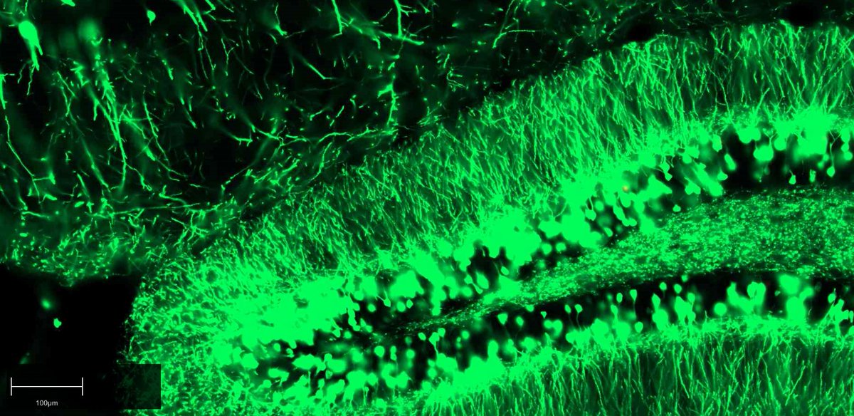 netScope Desk 1.11 is out now! 🎁
Distribute and analyze digital pathology images with new features and improvements.
Download it here: netscope.de/en/networking/…
#digitalpathology #imageanalysis #softwareupdate #netscopedesk