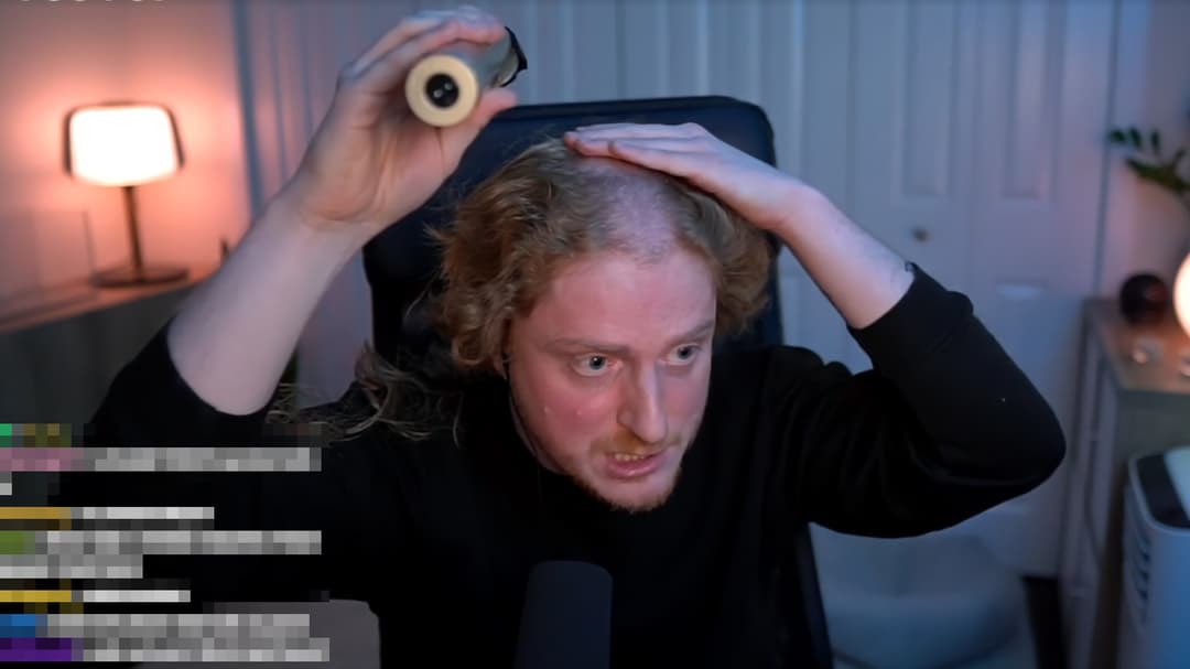 PopTingz's tweet photo. Many streamers and gamers are noticing indents in their heads due to prolonged headphone use. https://t.co/A3Nbsf6DqD