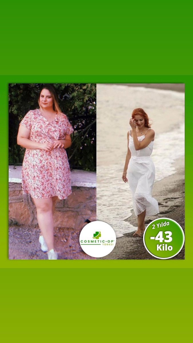 Cosmetic op Türkei #magenverkleinerung  in der Türkei