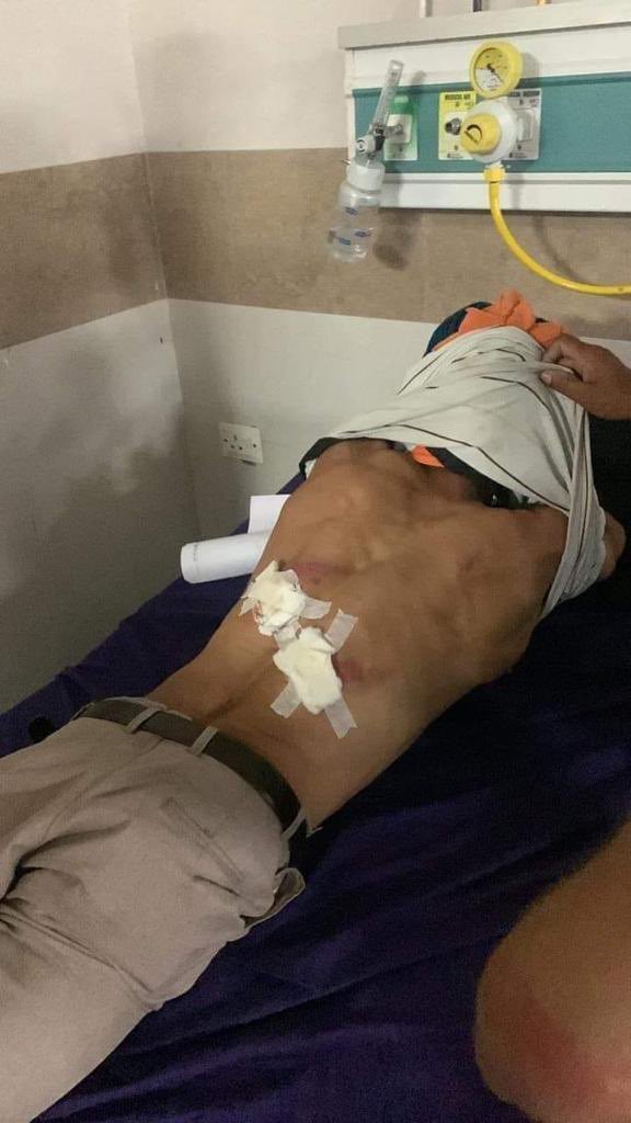 पुलिस लाठीचार्ज में घायल हुए किसानों के साथ पूरा देश खड़ा है. हरियाणा के शाहबाद से आयी किसानों की ये तस्वीरें देखकर आँखें नम हैं. 
…
ज़ुल्म और सब्र का ये खेल मुकम्मल हो जाए 
उस को ख़ंजर जो दिया है मुझे सर भी देना 
- मेराज फ़ैज़ाबादी