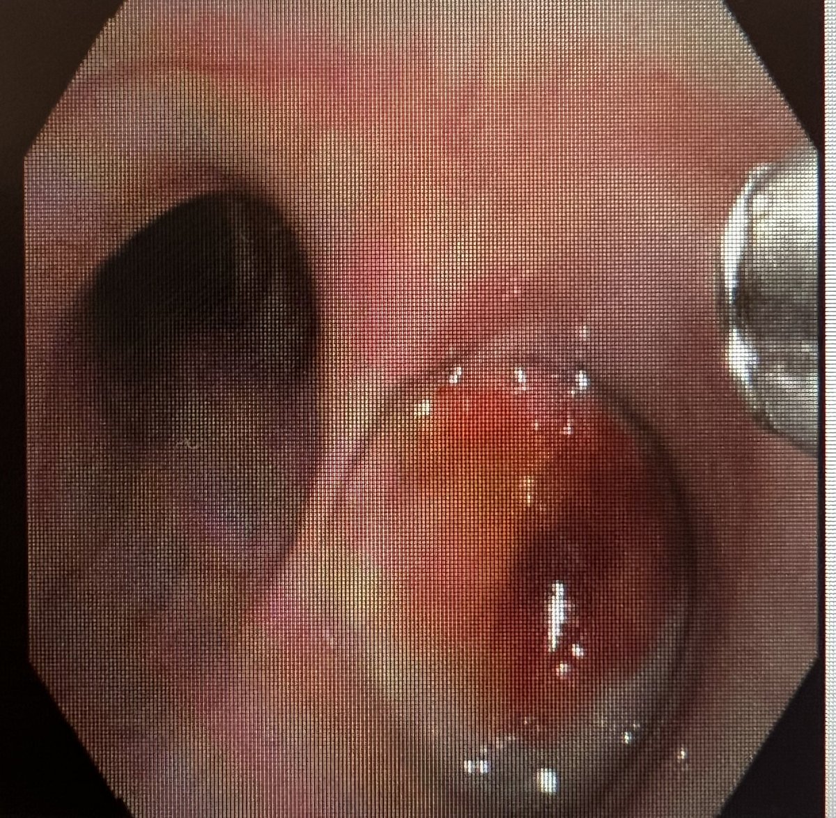 Catherine L. Oberg, MD tweet media