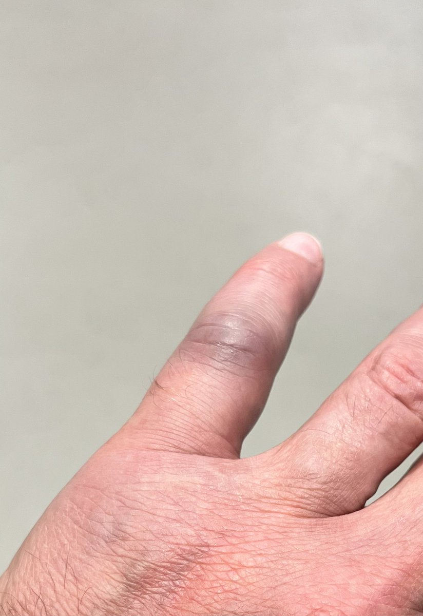 Dr Carl Austin-Behan OBE “Ozzy” 💙 tweet media