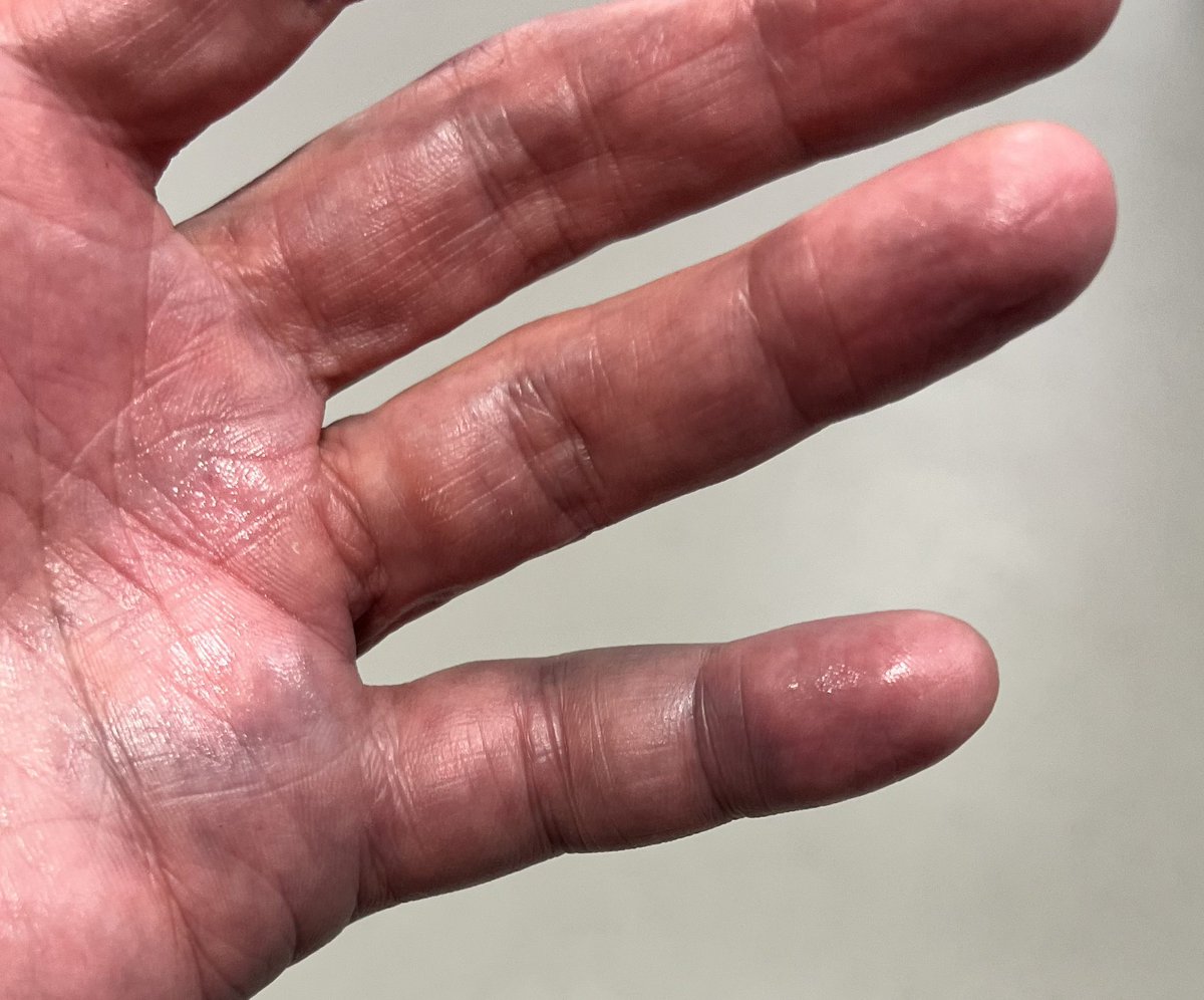 Dr Carl Austin-Behan OBE “Ozzy” 💙 tweet media