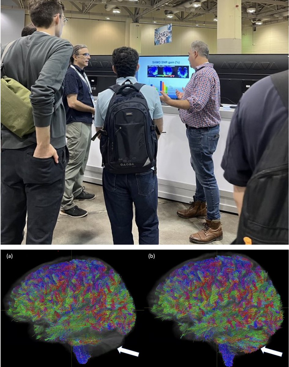MBCIU_UoM's tweet photo. A/Prof Brad Moffat presented his work on
Serial Acquisition of radiofrequency pulse MOdes (SAMO) for correction of transmit fieldinhomogeneities in ultra high field (7T) diffusion MRI (program number 2789) #ISMRM23 @themoff https://t.co/5Zg7NF6MjL