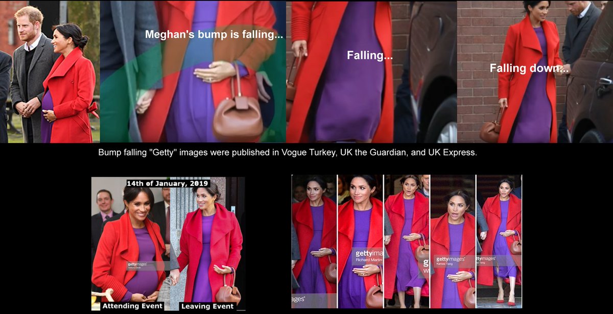 @AzureKbf @danwootton @piersmorgan @richardaeden @RE_DailyMail ♦ #PrinceHarry #MeghanMarkle lie to an unimaginable degree

♦ MM's bump fell: A sea of 'Getty photographers' captured that embarrassment
▶️Getty  bit.ly/3wjYBrg

♦ UK Law bit.ly/2R1XQ7d 
(deny) children born (using a surrogate) the right to succeed to titles.
