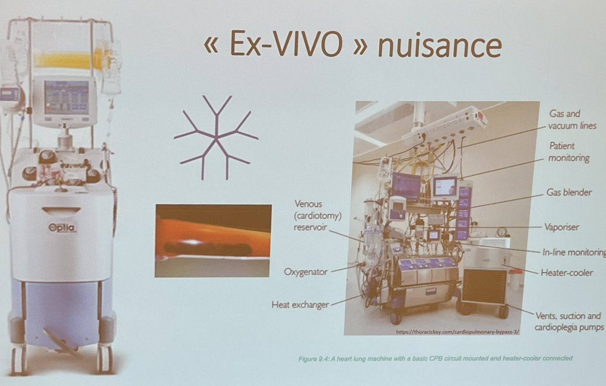 hvandermeulen's tweet photo. Dr Melissa Boileau reviews the challenge of apheresis in cold agglutinin disease @CanSocTransMed #cstm2023 https://t.co/5KNtFzeler