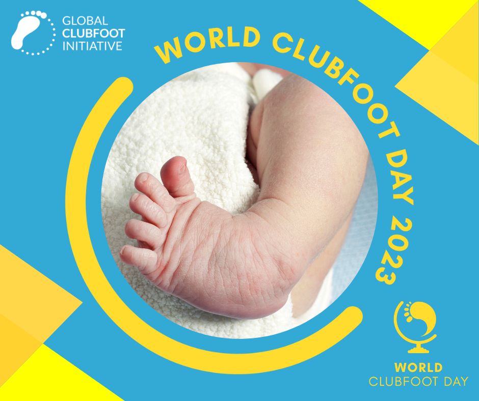 Clubfoot is one of the most common congenital birth conditions affecting 1 in 800 births globally. Today is World Clubfoot Day! Let's raise awareness about this condition and the importance of early intervention. Find out more here: bit.ly/GCIRunFree2030 #WCD2023